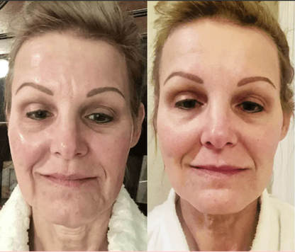 Masajeador Facial Con Terapia Led y Microvibración